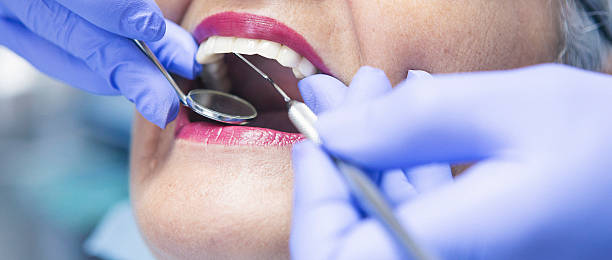 Best Emergency Cosmetic Dentistry (e.g., broken veneers) in Brookston, IN